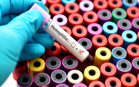 Ministerstwo Zdrowia i Narodowe Centrum Krwi zadeklarowało wsparcie dla dorosłych pacjentów z hemofilią